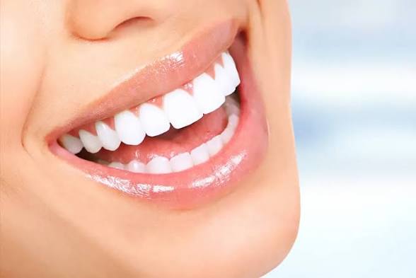 Limpeza+ Clareamento Dental